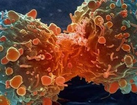Cilt kanserinde hızlı artış