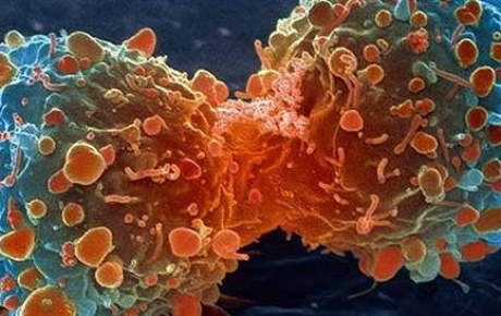 Cilt kanserinde hızlı artış