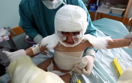 İsrail, Şifa Hastanesini bombaladı