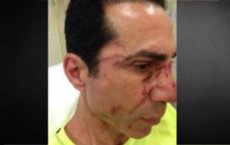 Arif sağın belediye meclis üyesi yeğenine saldırı