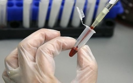 Dünya Sağlık Örgütünden kan testi önerisi