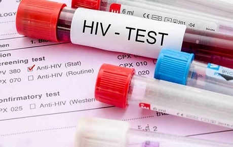 Aids Testi Nasıl Yapılır?