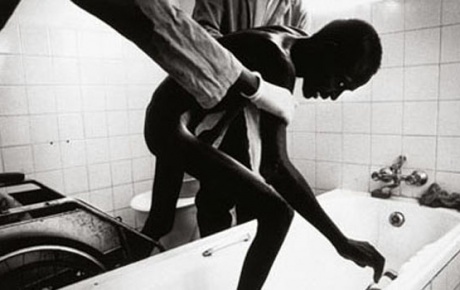 Afrikada erkekler AIDS tedavisine daha geç yanıt veriyor